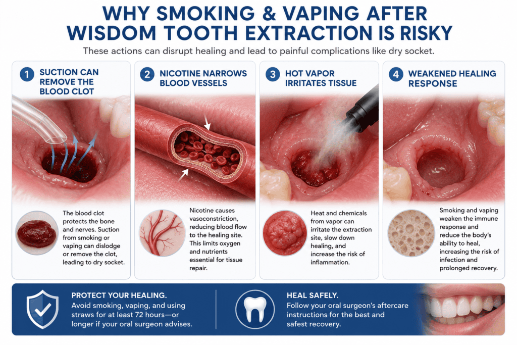 Vaping After Wisdom Teeth Removal: Quick Overview